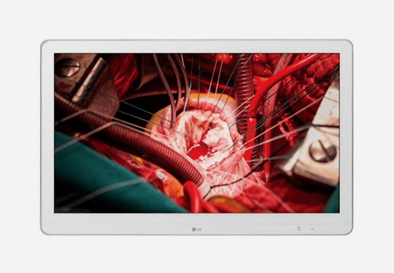 item-Monitor LG cirúrgico Full HD - 27